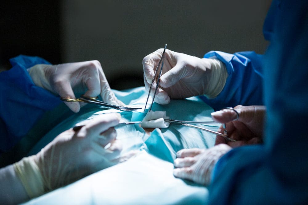 Oncología quirúrgica avanzada en Torreón con tecnología de vanguardia